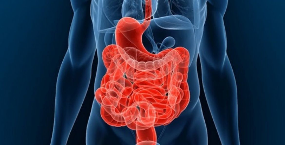 La maladie de Crohn - Meilleurs régimes minceur, comment perdre du